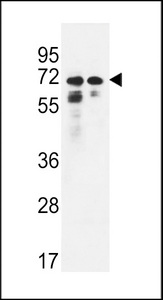 PNPLA8 Antibody - PNPLA8 Antibody western blot of HeLa,K562 cell line lysates (35 ug/lane). The PNPLA8 antibody detected the PNPLA8 protein (arrow).