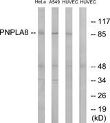 PNPLA8 Antibody - Western blot analysis of lysates from HUVEC, HeLa, and A549 cells, using PNPLA8 Antibody. The lane on the right is blocked with the synthesized peptide.