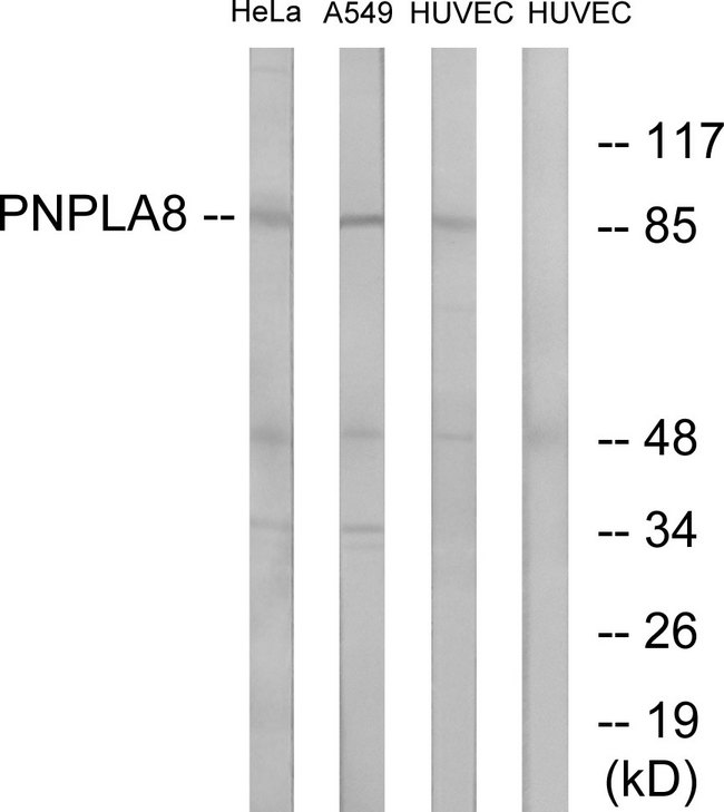 PNPLA8 Antibody - Western blot analysis of lysates from HUVEC, HeLa, and A549 cells, using PNPLA8 Antibody. The lane on the right is blocked with the synthesized peptide.