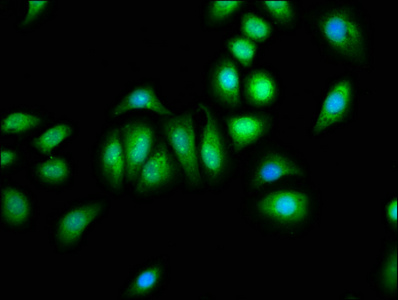 PNPLA8 Antibody - Immunofluorescence staining of A549 cells at a dilution of 1:133, counter-stained with DAPI. The cells were fixed in 4% formaldehyde, permeabilized using 0.2% Triton X-100 and blocked in 10% normal Goat Serum. The cells were then incubated with the antibody overnight at 4 °C.The secondary antibody was Alexa Fluor 488-congugated AffiniPure Goat Anti-Rabbit IgG (H+L) .