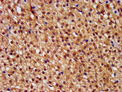 PNPLA8 Antibody - Immunohistochemistry image at a dilution of 1:400 and staining in paraffin-embedded human adrenal gland tissue performed on a Leica BondTM system. After dewaxing and hydration, antigen retrieval was mediated by high pressure in a citrate buffer (pH 6.0) . Section was blocked with 10% normal goat serum 30min at RT. Then primary antibody (1% BSA) was incubated at 4 °C overnight. The primary is detected by a biotinylated secondary antibody and visualized using an HRP conjugated SP system.