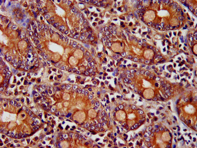 PNPLA8 Antibody - Immunohistochemistry image at a dilution of 1:400 and staining in paraffin-embedded human small intestine tissue performed on a Leica BondTM system. After dewaxing and hydration, antigen retrieval was mediated by high pressure in a citrate buffer (pH 6.0) . Section was blocked with 10% normal goat serum 30min at RT. Then primary antibody (1% BSA) was incubated at 4 °C overnight. The primary is detected by a biotinylated secondary antibody and visualized using an HRP conjugated SP system.
