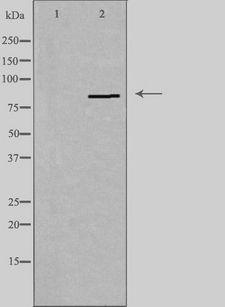 PNPLA8 Antibody - Western blot analysis of extracts of HeLa cells using PNPLA8 antibody. The lane on the left is treated with the antigen-specific peptide.