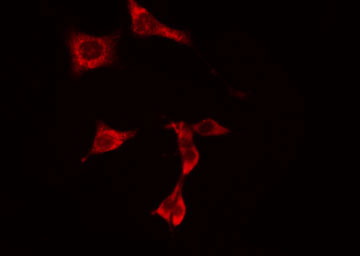 PNPLA8 Antibody - Staining HuvEc cells by IF/ICC. The samples were fixed with PFA and permeabilized in 0.1% Triton X-100, then blocked in 10% serum for 45 min at 25°C. The primary antibody was diluted at 1:200 and incubated with the sample for 1 hour at 37°C. An Alexa Fluor 594 conjugated goat anti-rabbit IgG (H+L) antibody, diluted at 1/600, was used as secondary antibody.