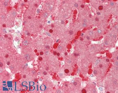 PNPO Antibody - Human Liver: Formalin-Fixed, Paraffin-Embedded (FFPE).  This image was taken for the unconjugated form of this product. Other forms have not been tested.