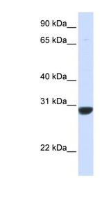 PNPO Antibody - PNPO antibody western blot of Human Fetal Muscle lysate.  This image was taken for the unconjugated form of this product. Other forms have not been tested.