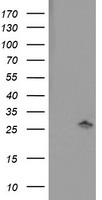 PNPO Antibody - HEK293T cells were transfected with the pCMV6-ENTRY control (Left lane) or pCMV6-ENTRY PNPO (Right lane) cDNA for 48 hrs and lysed. Equivalent amounts of cell lysates (5 ug per lane) were separated by SDS-PAGE and immunoblotted with anti-PNPO.