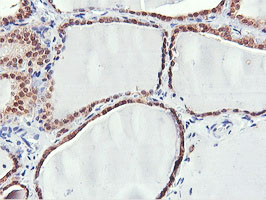 PNPO Antibody - IHC of paraffin-embedded Human thyroid tissue using anti-PNPO mouse monoclonal antibody.