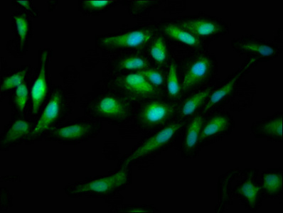 PNPO Antibody - Immunofluorescence staining of Hela cells at a dilution of 1:200, counter-stained with DAPI. The cells were fixed in 4% formaldehyde, permeabilized using 0.2% Triton X-100 and blocked in 10% normal Goat Serum. The cells were then incubated with the antibody overnight at 4 °C.The secondary antibody was Alexa Fluor 488-congugated AffiniPure Goat Anti-Rabbit IgG (H+L) .