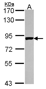 PNPT1 Antibody - Sample (30 ug of whole cell lysate). A: A431 . 7.5% SDS PAGE. PNPT1 antibody diluted at 1:1000.