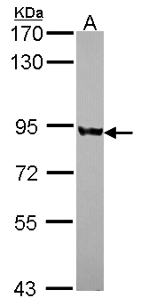 PNPT1 Antibody - Sample (30 ug of whole cell lysate). A: JurKat. 7.5% SDS PAGE. PNPT1 antibody diluted at 1:1000.