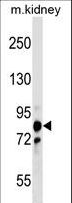 PNPT1 Antibody - PNPT1 Antibody western blot of mouse kidney tissue lysates (35 ug/lane). The PNPT1 antibody detected the PNPT1 protein (arrow).
