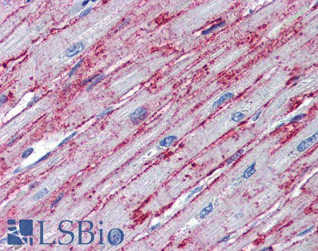PNPT1 Antibody - Anti-PNPT1 antibody IHC of human heart. Immunohistochemistry of formalin-fixed, paraffin-embedded tissue after heat-induced antigen retrieval. Antibody concentration 5 ug/ml.  This image was taken for the unconjugated form of this product. Other forms have not been tested.