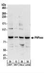 PNPT1 Antibody - Detection of Human PNPase by Western Blot. Samples: Whole cell lysate from 293T (15 and 50 ug), HeLa (50 ug), and Jurkat (50 ug) cells. Antibodies: Affinity purified rabbit anti-PNPase antibody used for WB at 0.4 ug/ml. Detection: Chemiluminescence with an exposure time of 3 minutes.