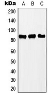 PNPT1 Antibody - Western blot analysis of PNPT1 expression in Jurkat (A); MCF7 (B); HeLa (C) whole cell lysates.