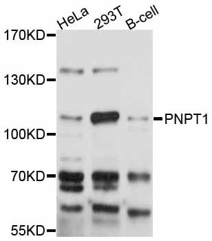 PNPT1 Antibody - Western blot analysis of extracts of various cell lines, using PNPT1 antibody at 1:3000 dilution. The secondary antibody used was an HRP Goat Anti-Rabbit IgG (H+L) at 1:10000 dilution. Lysates were loaded 25ug per lane and 3% nonfat dry milk in TBST was used for blocking. An ECL Kit was used for detection and the exposure time was 10s.