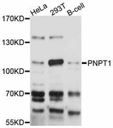 PNPT1 Antibody - Western blot analysis of extracts of various cell lines, using PNPT1 antibody at 1:3000 dilution. The secondary antibody used was an HRP Goat Anti-Rabbit IgG (H+L) at 1:10000 dilution. Lysates were loaded 25ug per lane and 3% nonfat dry milk in TBST was used for blocking. An ECL Kit was used for detection and the exposure time was 10s.