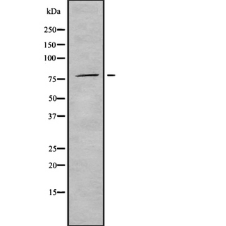 PNPT1 Antibody - Western blot analysis of PNPase using HeLa whole cells lysates