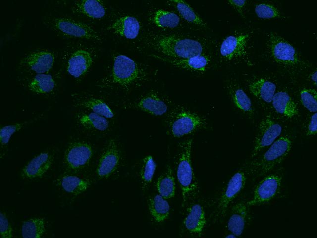 PNPT1 Antibody - Immunofluorescence staining of PNPT1 in U2OS cells. Cells were fixed with 4% PFA, permeabilzed with 0.1% Triton X-100 in PBS, blocked with 10% serum, and incubated with rabbit anti-Human PNPT1 polyclonal antibody (dilution ratio 1:200) at 4°C overnight. Then cells were stained with the Alexa Fluor 488-conjugated Goat Anti-rabbit IgG secondary antibody (green) and counterstained with DAPI (blue). Positive staining was localized to Cytoplasm.