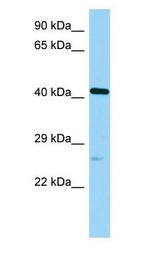 POC1A / SOFT Antibody - POC1A / SOFT antibody Western Blot of Rat Pancreas.  This image was taken for the unconjugated form of this product. Other forms have not been tested.