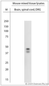 POC1A / SOFT Antibody - WB on mouse tissue lysates. Blocking: 1% LFDM for 30 min at RT; primary antibody: dilution 1:1000 incubated at 4°C overnight.
