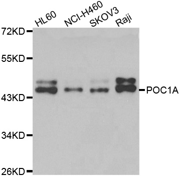 POC1A / SOFT Antibody - Western blot analysis of extracts of various cell lines.
