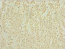 POC1A / SOFT Antibody - Immunohistochemistry of paraffin-embedded human adrenal gland tissue at dilution 1:100