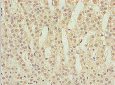 POC1A / SOFT Antibody - Immunohistochemistry of paraffin-embedded human adrenal gland tissue at dilution 1:100