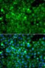 POC1A / SOFT Antibody - Immunofluorescence analysis of A549 cells using POC1A Polyclonal Antibody.
