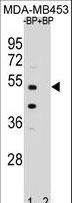 POC1B / WDR51B Antibody - Western blot of WDR51B Antibody antibody pre-incubated without(lane 1) and with(lane 2) blocking peptide in MDA-MB453 cell line lysate. WDR51B Antibody (arrow) was detected using the purified antibody.