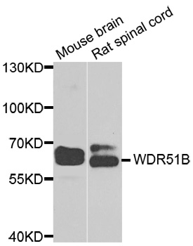 POC1B / WDR51B Antibody - Western blot analysis of extracts of various cell lines.