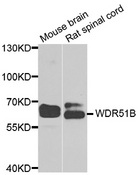 POC1B / WDR51B Antibody - Western blot analysis of extracts of various cell lines.