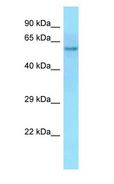POC5 Antibody - POC5 antibody Western Blot of HeLa.  This image was taken for the unconjugated form of this product. Other forms have not been tested.
