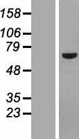 POC5 Protein - Western validation with an anti-DDK antibody * L: Control HEK293 lysate R: Over-expression lysate