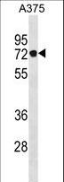 PODN Antibody - PODN Antibody western blot of A375 cell line lysates (35 ug/lane). The PODN antibody detected the PODN protein (arrow).
