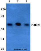 PODN Antibody - Western blot of PODN antibody at 1:500 dilution. Lane 1: HEK293T whole cell lysate. Lane 2: sp2/0 whole cell lysate. Lane 3: PC12 whole cell lysate.