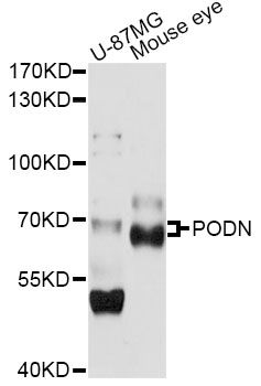 PODN Antibody - Western blot analysis of extracts of various cell lines, using PODN antibody at 1:1000 dilution. The secondary antibody used was an HRP Goat Anti-Rabbit IgG (H+L) at 1:10000 dilution. Lysates were loaded 25ug per lane and 3% nonfat dry milk in TBST was used for blocking. An ECL Kit was used for detection and the exposure time was 10s.