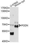 PODN Antibody - Western blot analysis of extracts of various cell lines, using PODN antibody at 1:1000 dilution. The secondary antibody used was an HRP Goat Anti-Rabbit IgG (H+L) at 1:10000 dilution. Lysates were loaded 25ug per lane and 3% nonfat dry milk in TBST was used for blocking. An ECL Kit was used for detection and the exposure time was 10s.