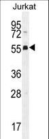 PODNL1 Antibody - PODNL1 Antibody western blot of Jurkat cell line lysates (35 ug/lane). The PODNL1 antibody detected the PODNL1 protein (arrow).