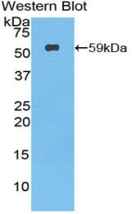 PODXL / Podocalyxin Antibody - Western blot of recombinant PODXL / Podocalyxin.  This image was taken for the unconjugated form of this product. Other forms have not been tested.