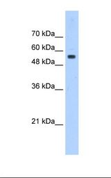 PODXL / Podocalyxin Antibody - Jurkat cell lysate. Antibody concentration: 0.5 ug/ml. Gel concentration: 12%.  This image was taken for the unconjugated form of this product. Other forms have not been tested.