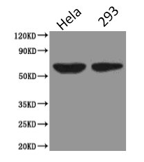 PODXL / Podocalyxin Antibody - Western Blot Positive WB detected in:Hela whole cell lysate,HEK293 whole cell lysate All lanes : PODXL antibody at 2.5 ug/ml Secondary Goat polyclonal to Mouse IgG at 1/5000 dilution Predicted band size: 59, 56 kDa Observed band size: 59 kDa