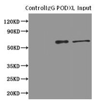 PODXL / Podocalyxin Antibody