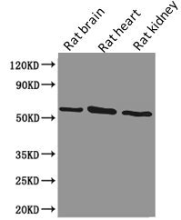 PODXL / Podocalyxin Antibody - Western Blot Positive WB detected in: Rat brain tissue, Rat heart tissue, Rat kidney tissue All lanes: PODXL antibody at 1.28µg/ml Secondary Goat polyclonal to Mouse IgG at 1/5000 dilution Predicted band size: 59, 56 kDa Observed band size: 59 kDa