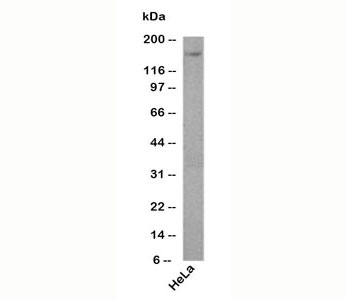 PODXL / Podocalyxin Antibody - Podocalyxin antibody 3D3 western blot.  This image was taken for the unmodified form of this product. Other forms have not been tested.