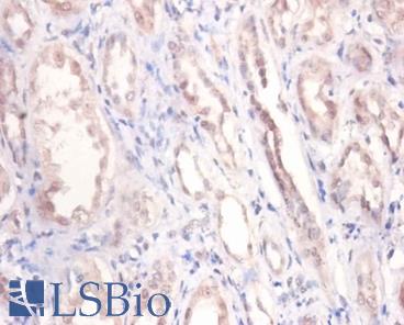 PODXL / Podocalyxin Antibody - Immunohistochemistry of paraffin-embedded human kidney using PODXL / Podocalyxin antibody at dilution of 1:100.  This image was taken for the unconjugated form of this product. Other forms have not been tested.