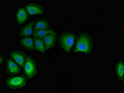 PODXL / Podocalyxin Antibody - Immunofluorescent analysis of A549 cells using PODXL Antibody at dilution of 1:100 and Alexa Fluor 488-congugated AffiniPure Goat Anti-Rabbit IgG(H+L)