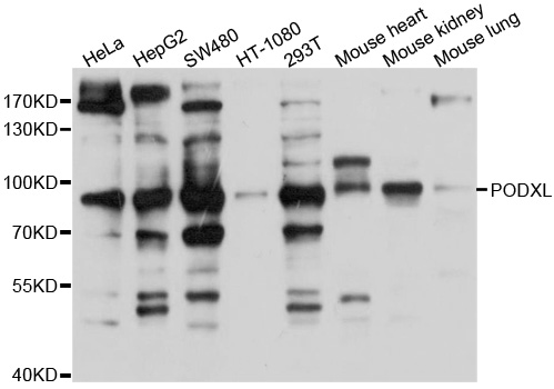 PODXL / Podocalyxin Antibody - Western blot analysis of extracts of various cell lines, using PODXL antibody at 1:1000 dilution. The secondary antibody used was an HRP Goat Anti-Rabbit IgG (H+L) at 1:10000 dilution. Lysates were loaded 25ug per lane and 3% nonfat dry milk in TBST was used for blocking. An ECL Kit was used for detection and the exposure time was 3s.