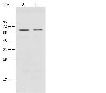 PODXL / Podocalyxin Antibody - Anti-PODXL rabbit polyclonal antibody at 1:500 dilution. Lane A: HeLa Whole Cell Lysate. Lane B: Jurkat Whole Cell Lysate. Lysates/proteins at 30 ug per lane. Secondary: Goat Anti-Rabbit IgG (H+L)/HRP at 1/10000 dilution. Developed using the ECL technique. Performed under reducing conditions. Predicted band size: 58 kDa. Observed band size: 58 kDa.