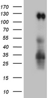 PODXL2 / Endoglycan Antibody - HEK293T cells were transfected with the pCMV6-ENTRY control. (Left lane) or pCMV6-ENTRY PODXL2. (Right lane) cDNA for 48 hrs and lysed